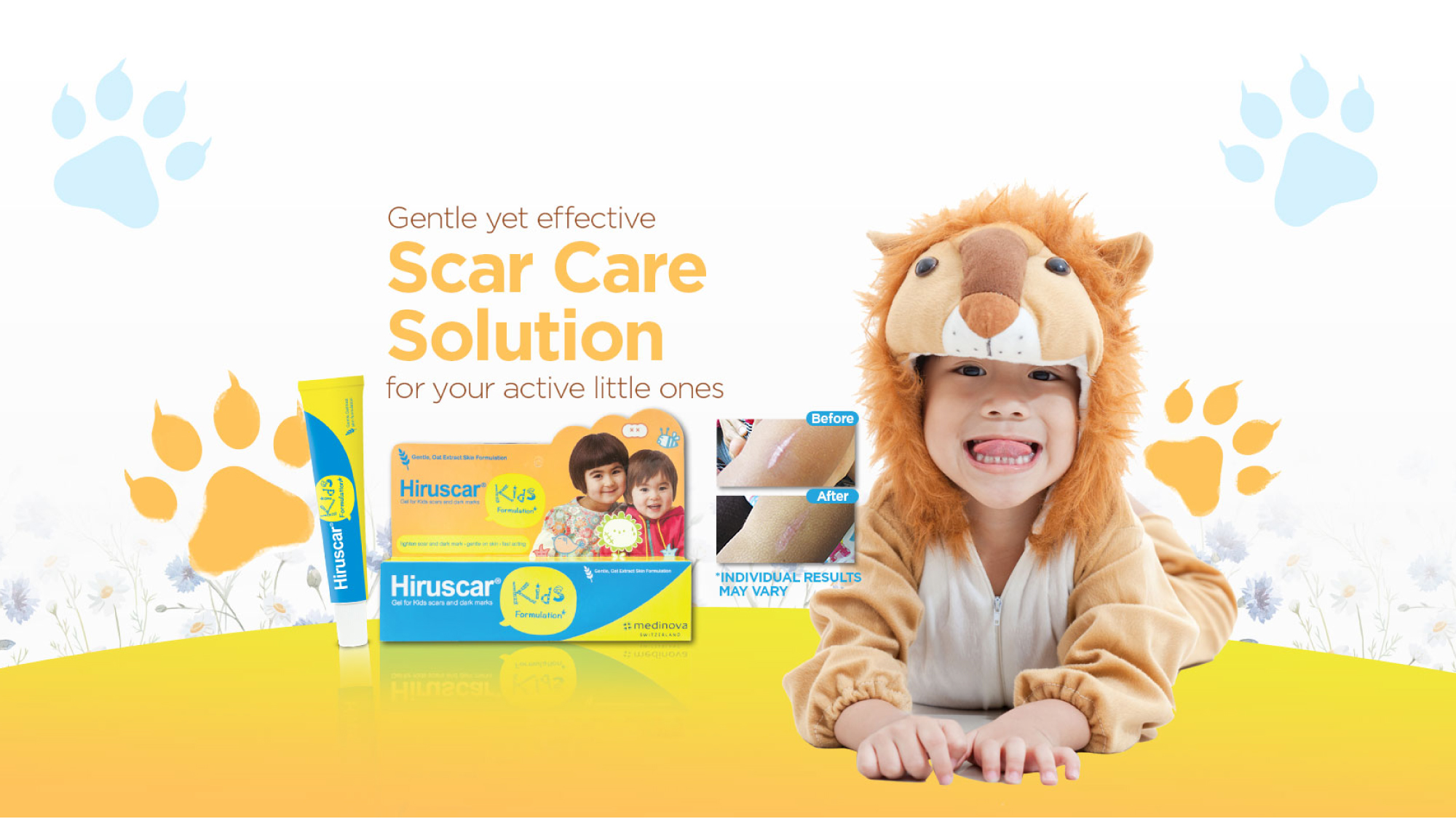 Scar Care Gel for Kids